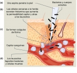 La respuesta inflamatoria